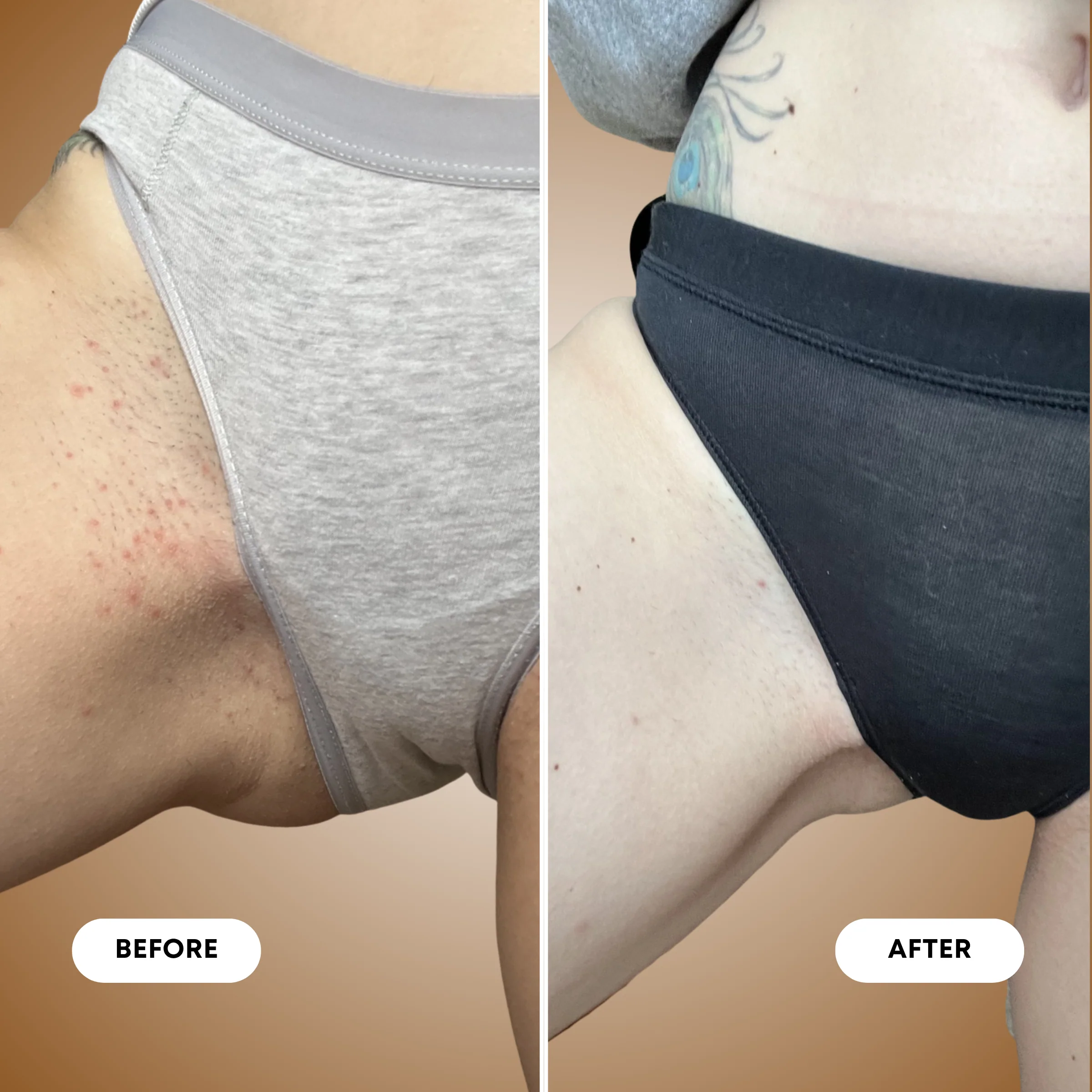 Vanilla Coconut Ingrown Exfoliating Scrub - Image 6