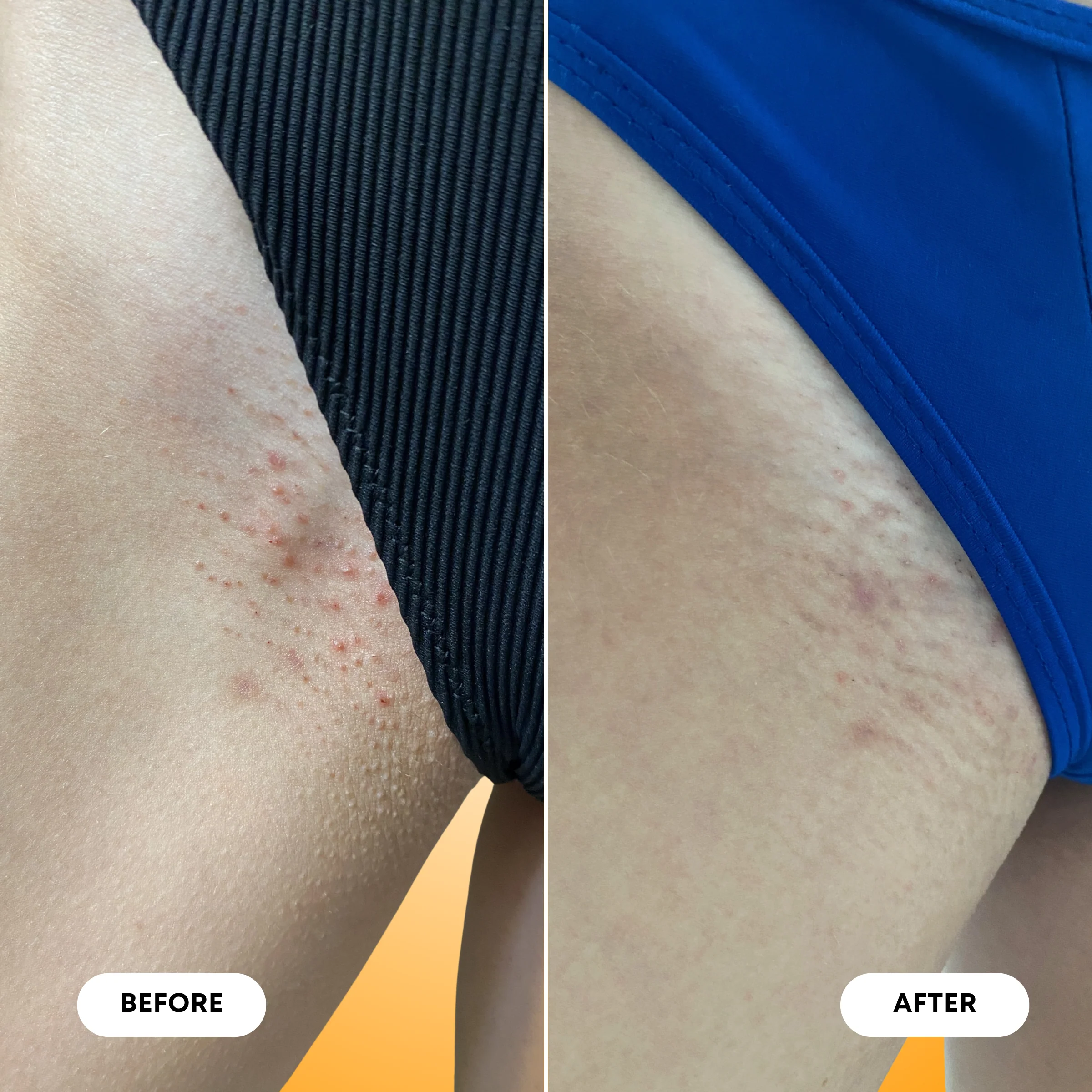 Vanilla Tangerine Ingrown Hair 2 Step Routine - Image 8