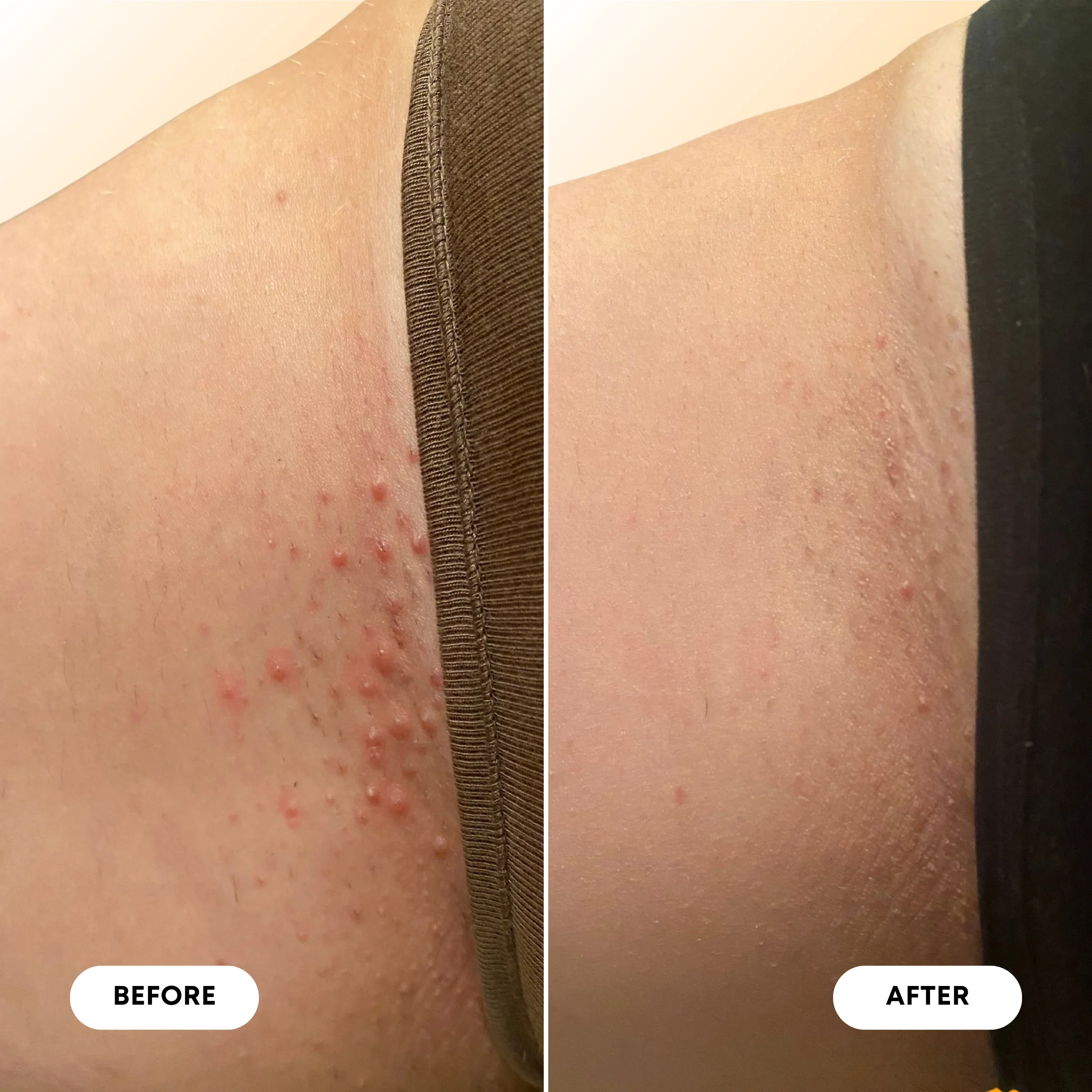 Vanilla Tangerine Ingrown Hair Oil - Image 8
